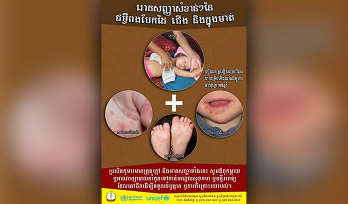 保健省、手足口病の流行を警告
