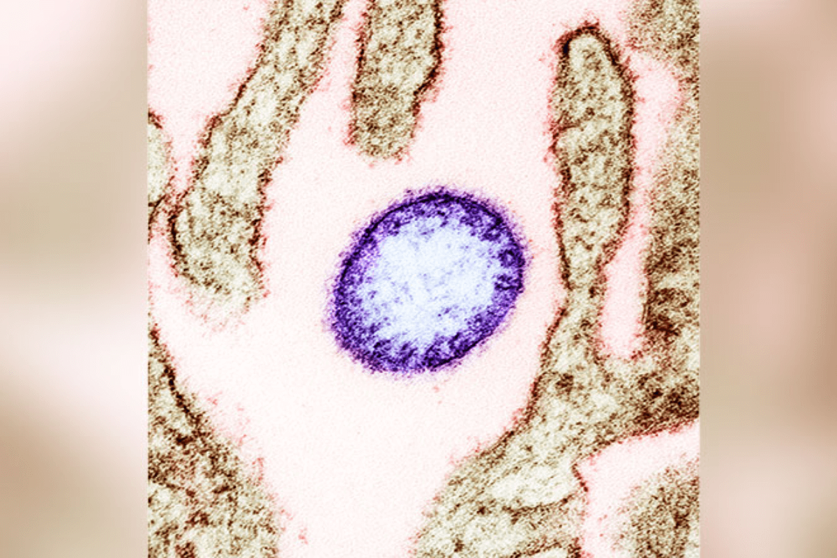 インドで広がるニパウイルス、カンボジアが警戒を強化