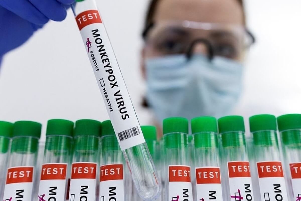 世界的なサル痘流行、ベトナムは検査能力の欠如に直面