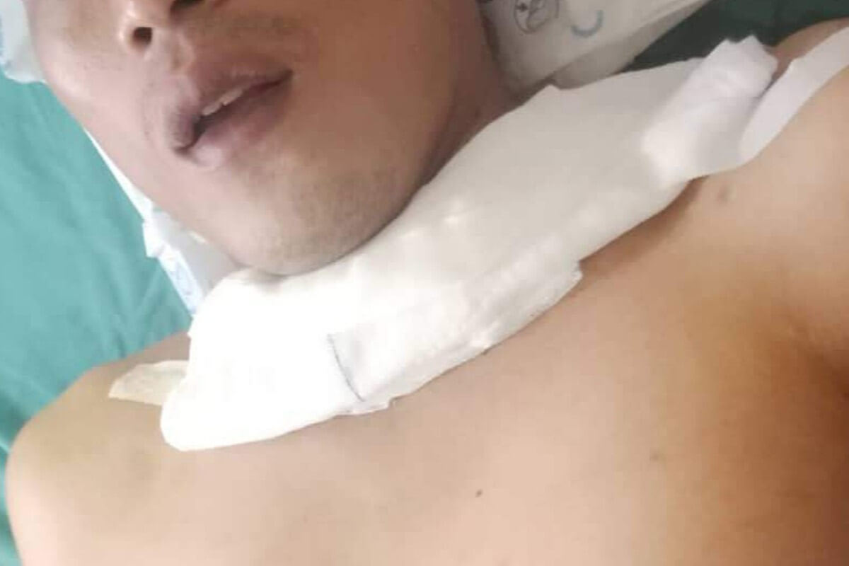 ホーチミン市の男性、バイク走行中にタコ糸で首を負傷