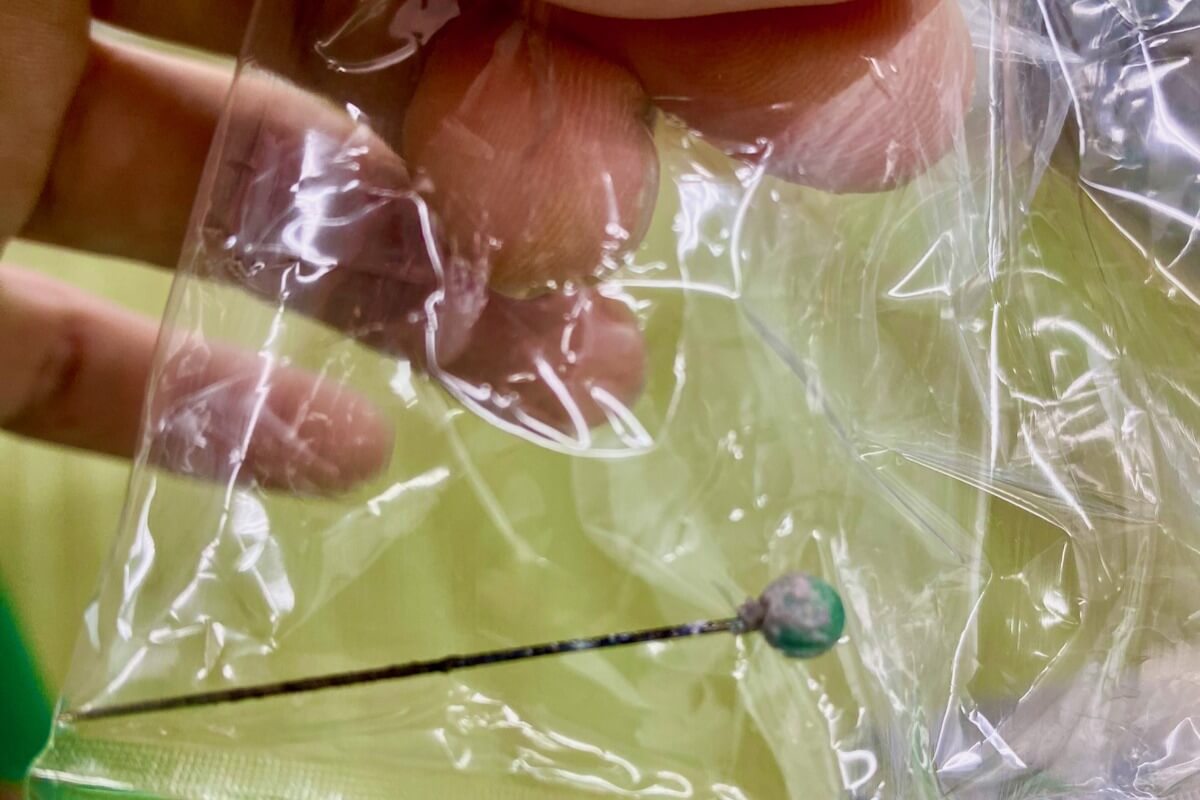 カインホア省の変質者、7歳男児の尿道に針を刺す