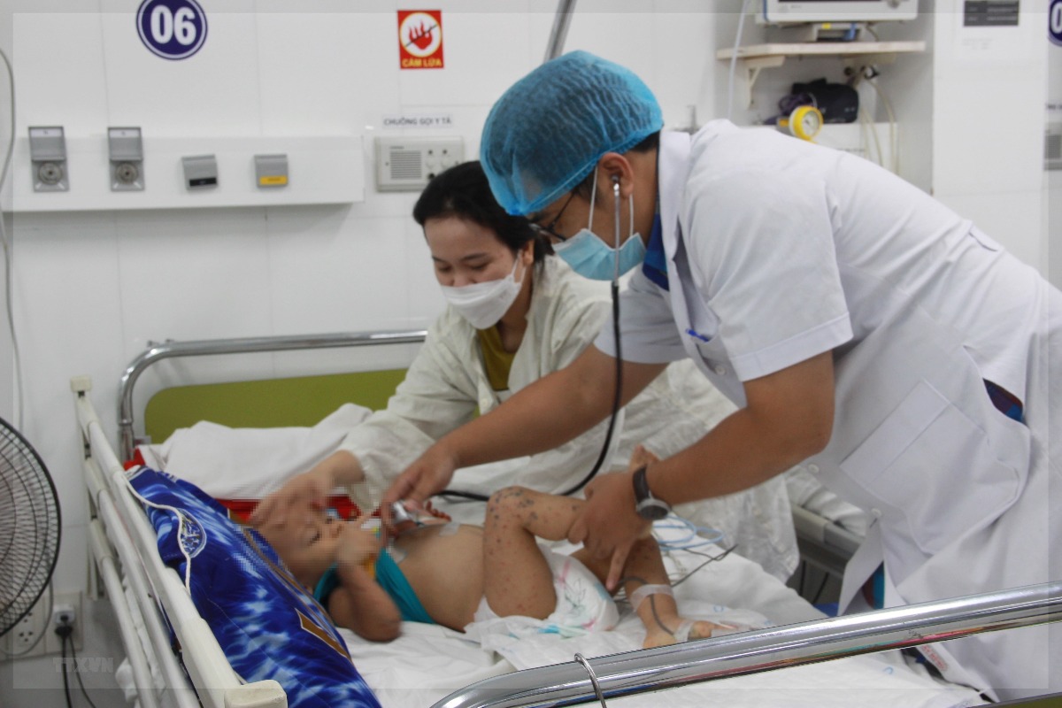 ベトナムの手足口病患者数、8ヶ月間で6万8000人超