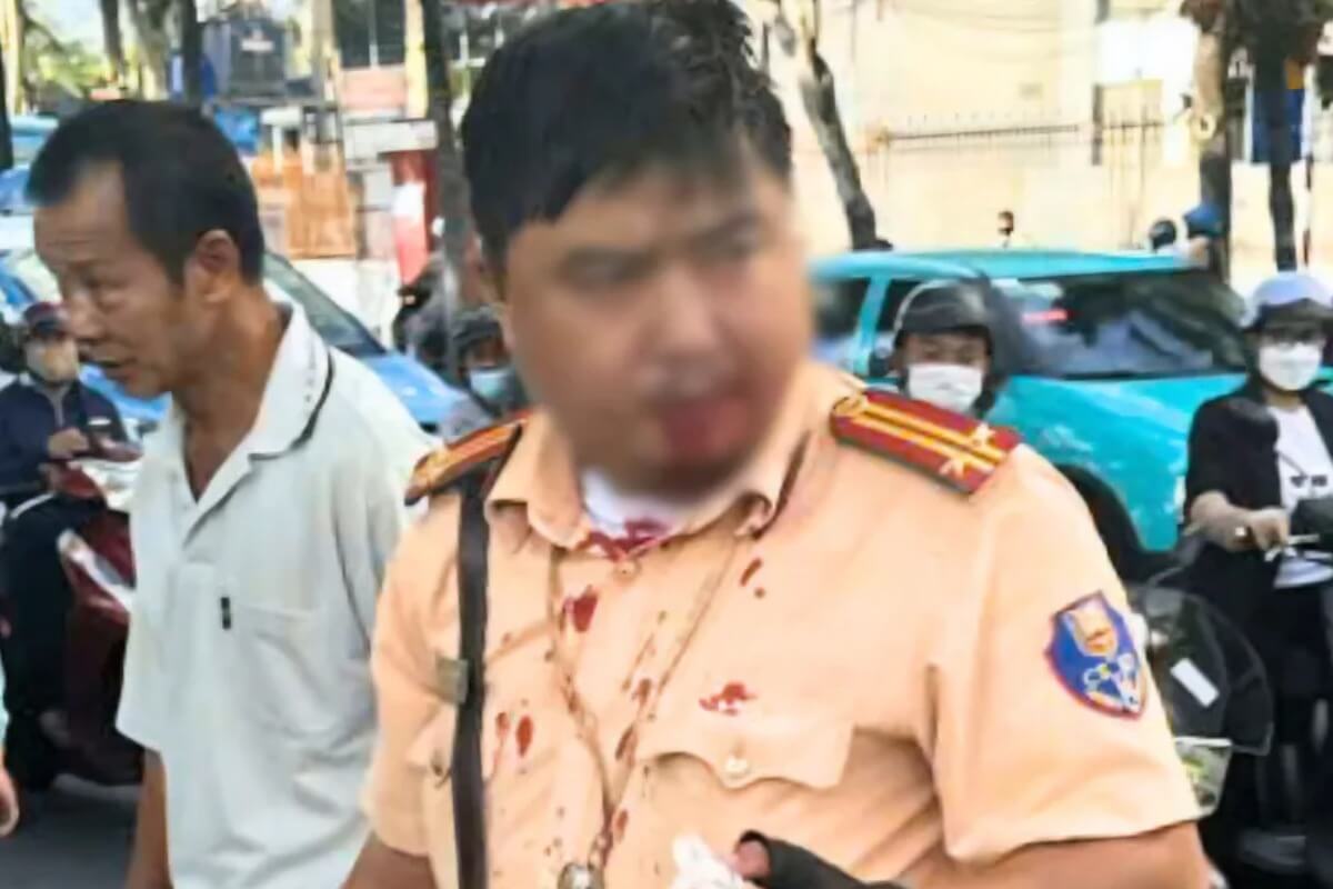 勤務中の交通警察官、外国人男性により殴打
