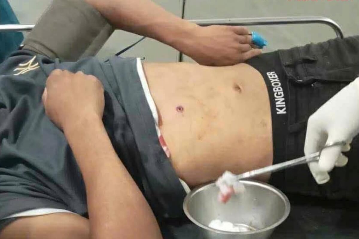 道端で若者が銃撃され死亡、不審者への声かけが発端