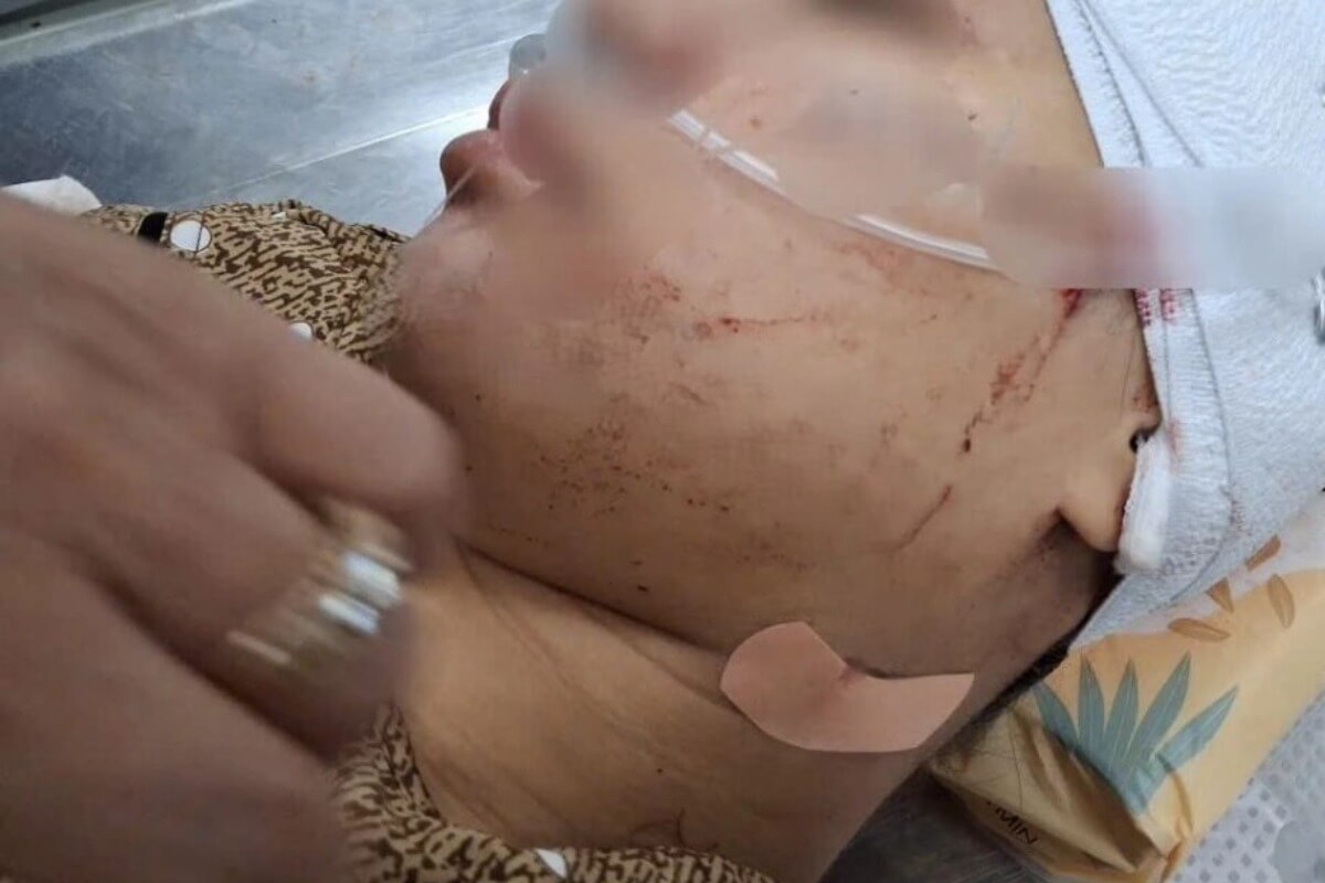 飲み会に嫉妬で激昂した妻、突撃して女性の顔をカッターで刺傷