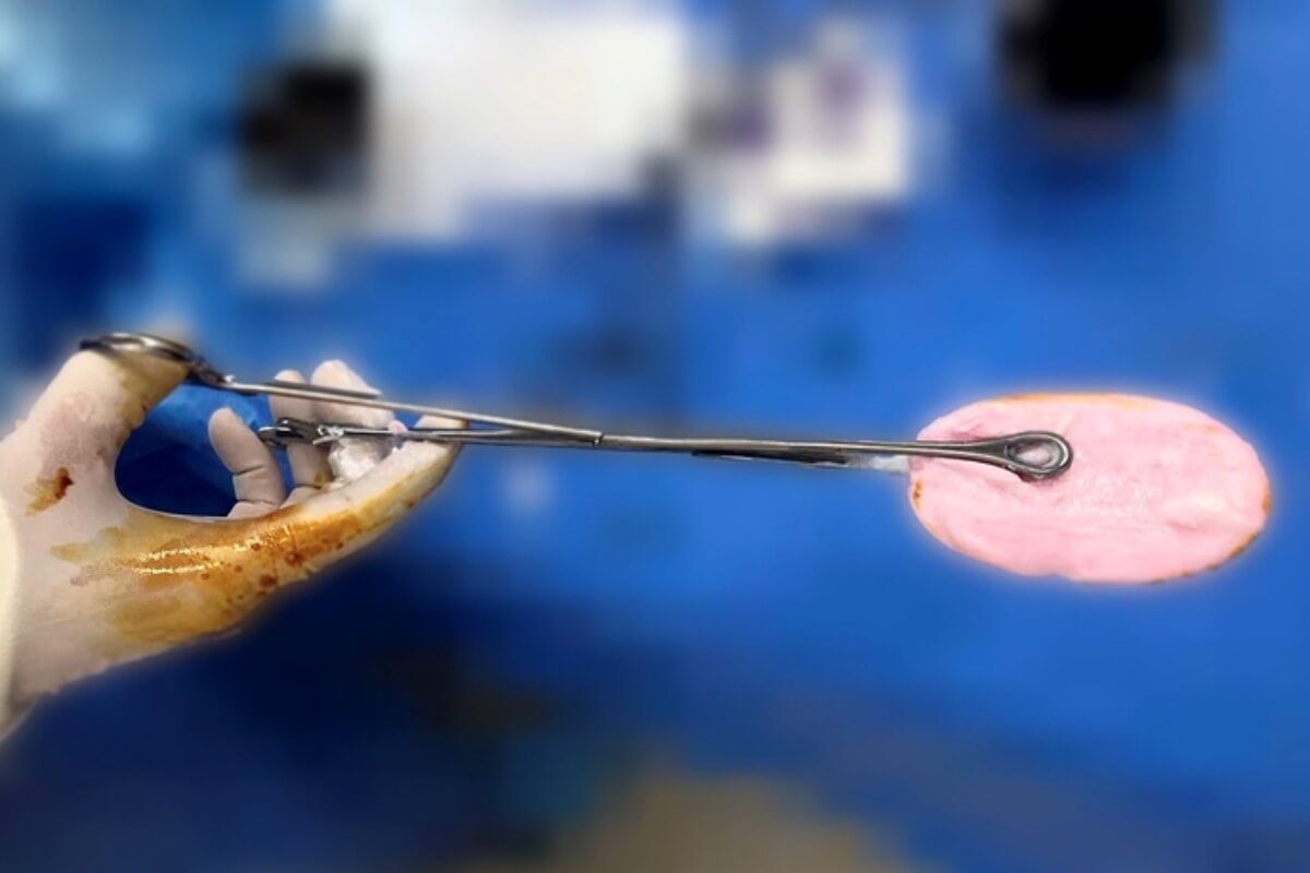 10代前半女性に広がる異物挿入、危険行為と性教育の課題