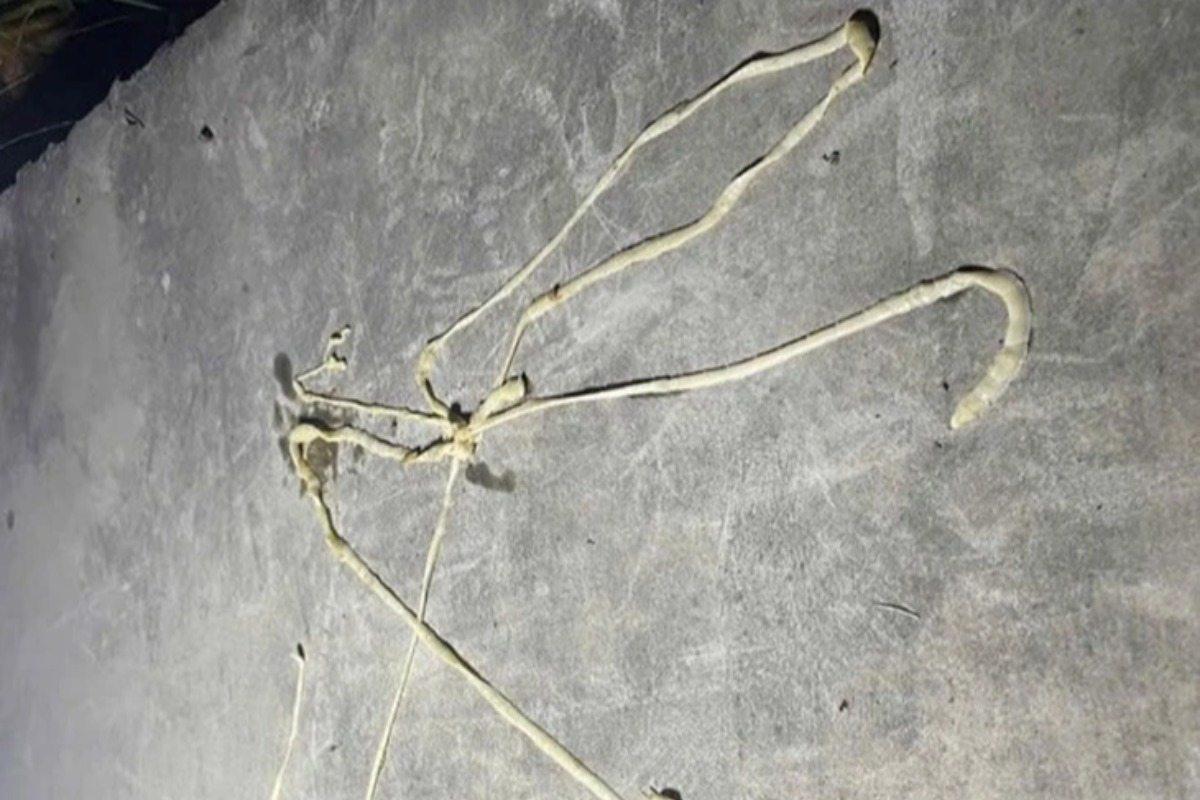 ハイフォン市の男性、10mのサナダムシを排出