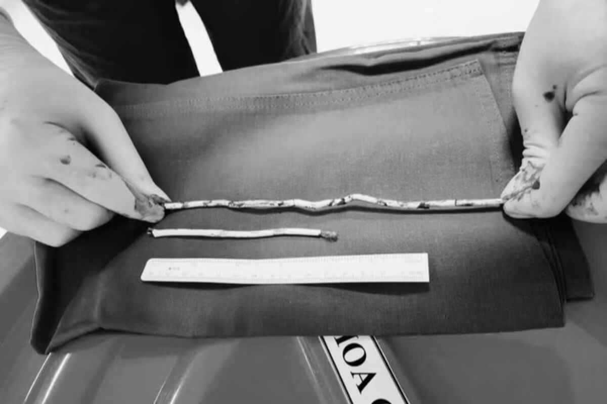 SNS動画を模倣した少年、尿道にLANケーブルで緊急手術