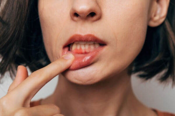 手遅れになると怖い歯周病｜ありが歯科で予防・治療