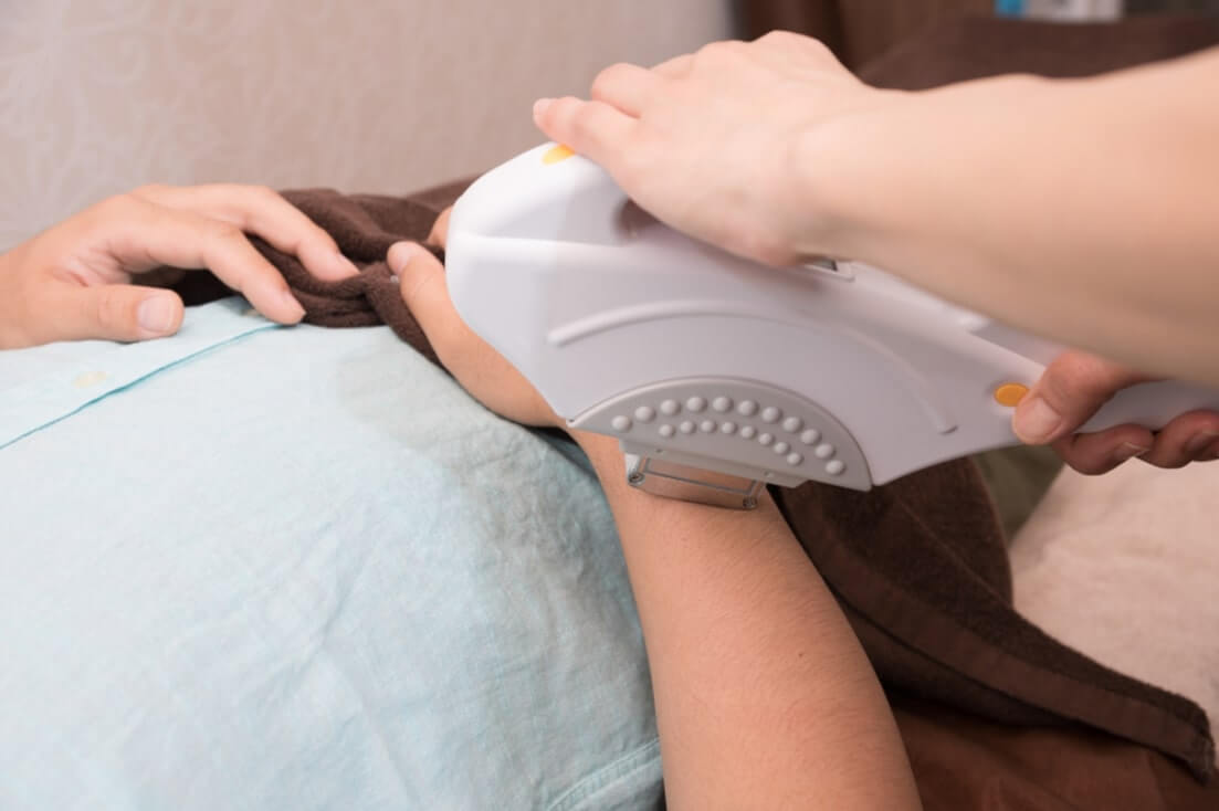 デコラ,DECORA,ハノイ,リンラン,脱毛,男性,永久脱毛,医療脱毛