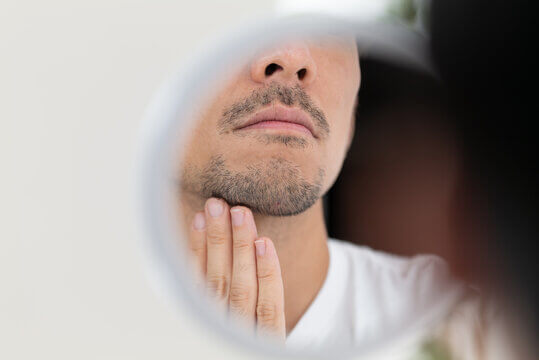 デコラ,DECORA,ハノイ,リンラン,脱毛,男性,永久脱毛,医療脱毛